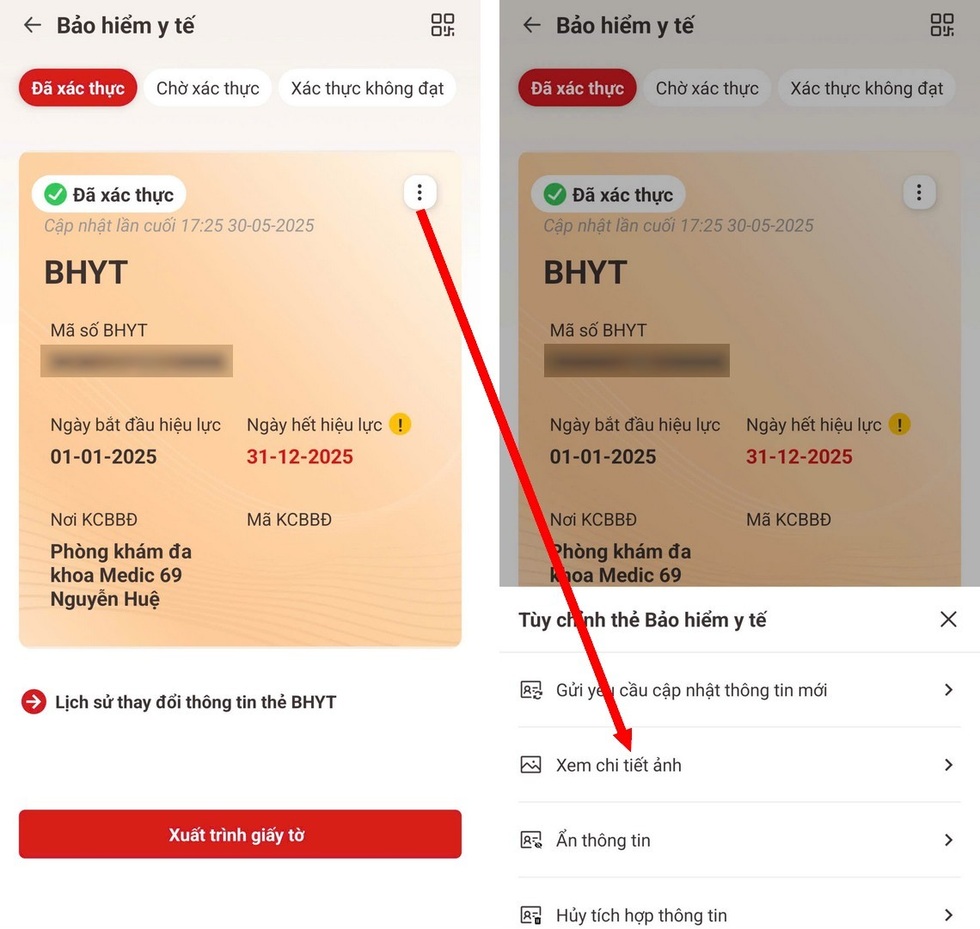 Cách xử lý khi thẻ BHYT điện tử hết hạn hoặc thông tin trên VNeID sai lệch - 2