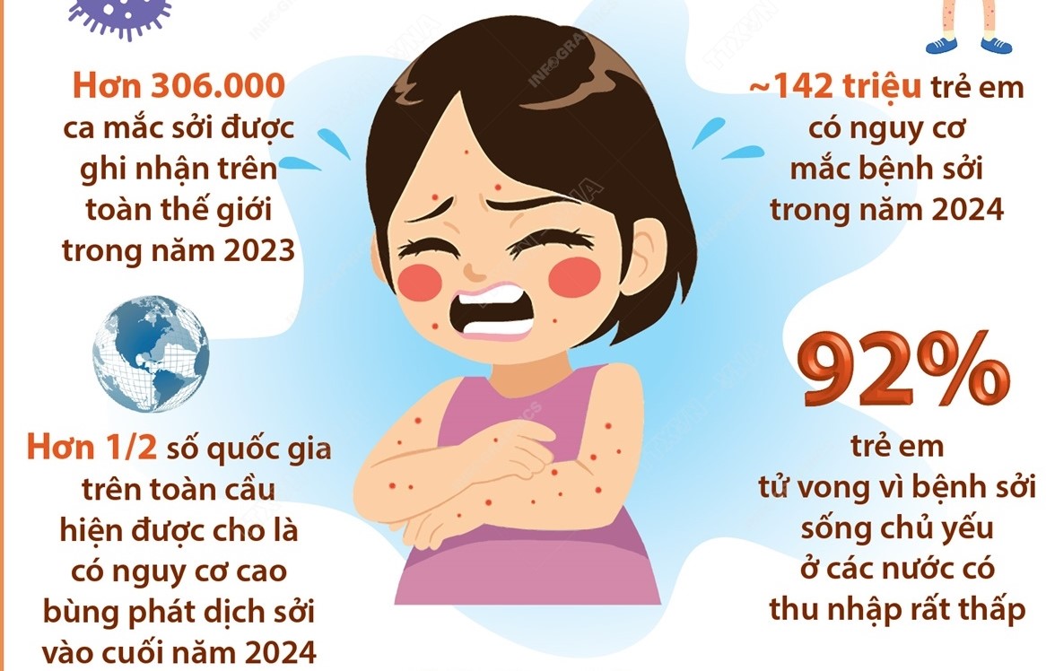 Tổ chức Y tế Thế giới cảnh báo sự lây lan nhanh chóng của bệnh sởi