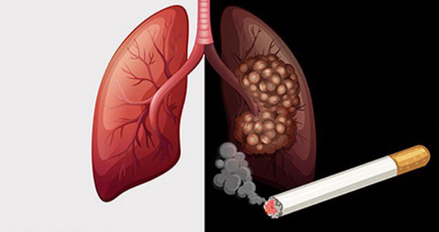 Hút thuốc lá và nguy cơ cao ung thư phổi | Cổng TTĐT tỉnh Hà Tĩnh
